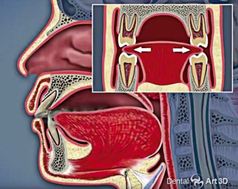 dental art 3d apnoe